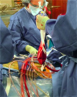 The hemobag® in operation room